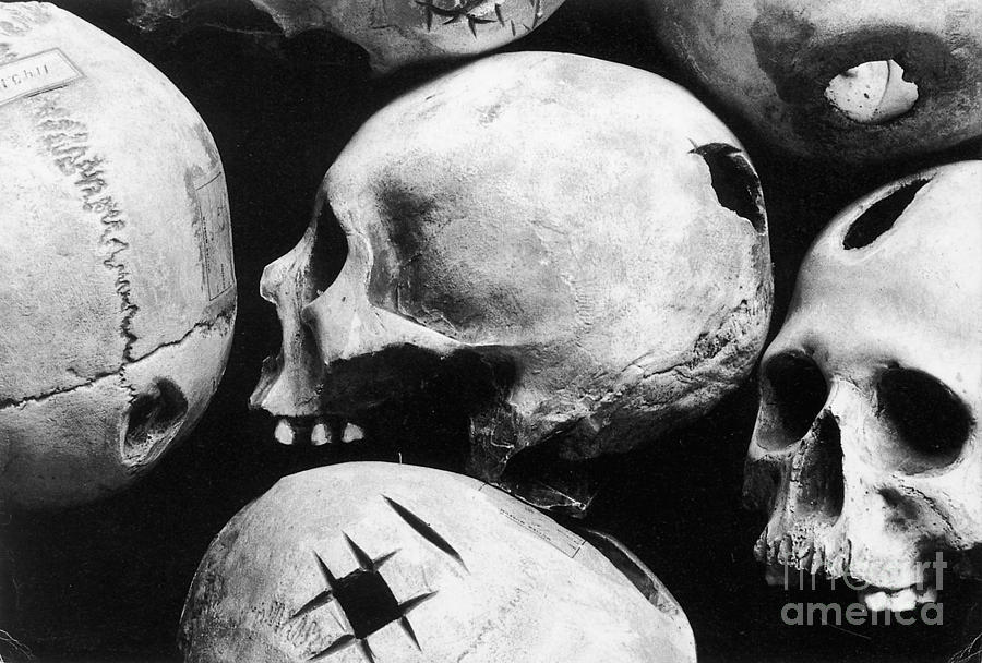 Skulls Showing Trepanation Photograph by Science Source