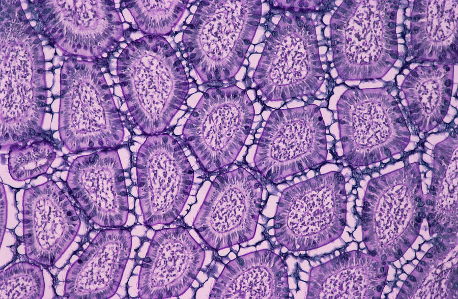 Villus Photograph - Small Intestine, Light Micrograph by Dr. E. Walker