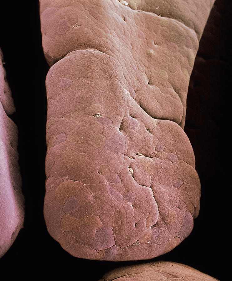 Intestinal Photograph - Small Intestine Villus, Sem by Steve Gschmeissner