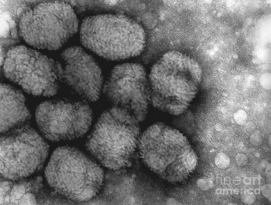 Smallpox Virus Photograph by Science Source