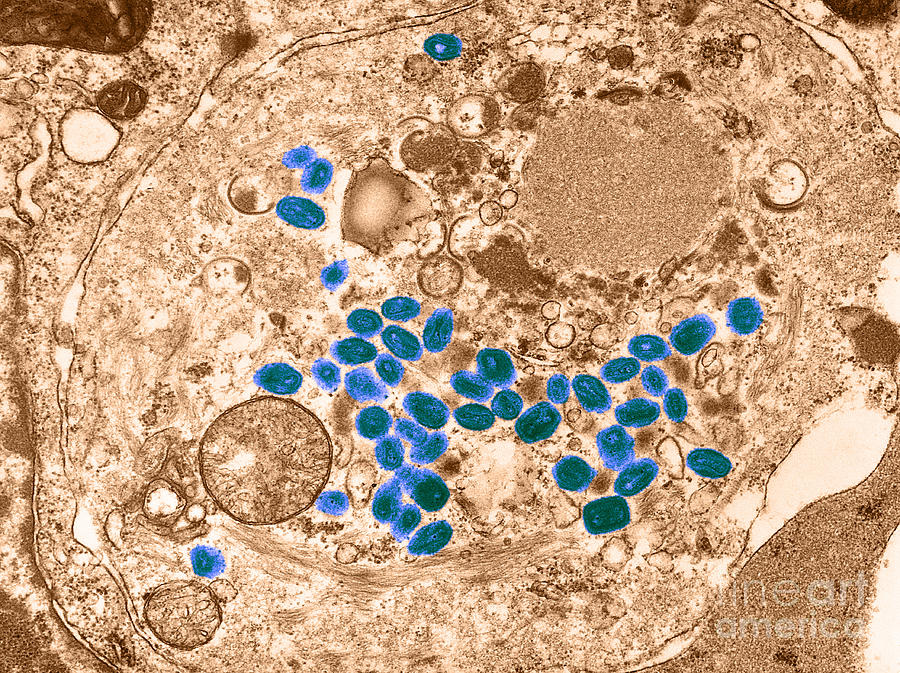 Smallpox Virus, Tem Photograph by Science Source