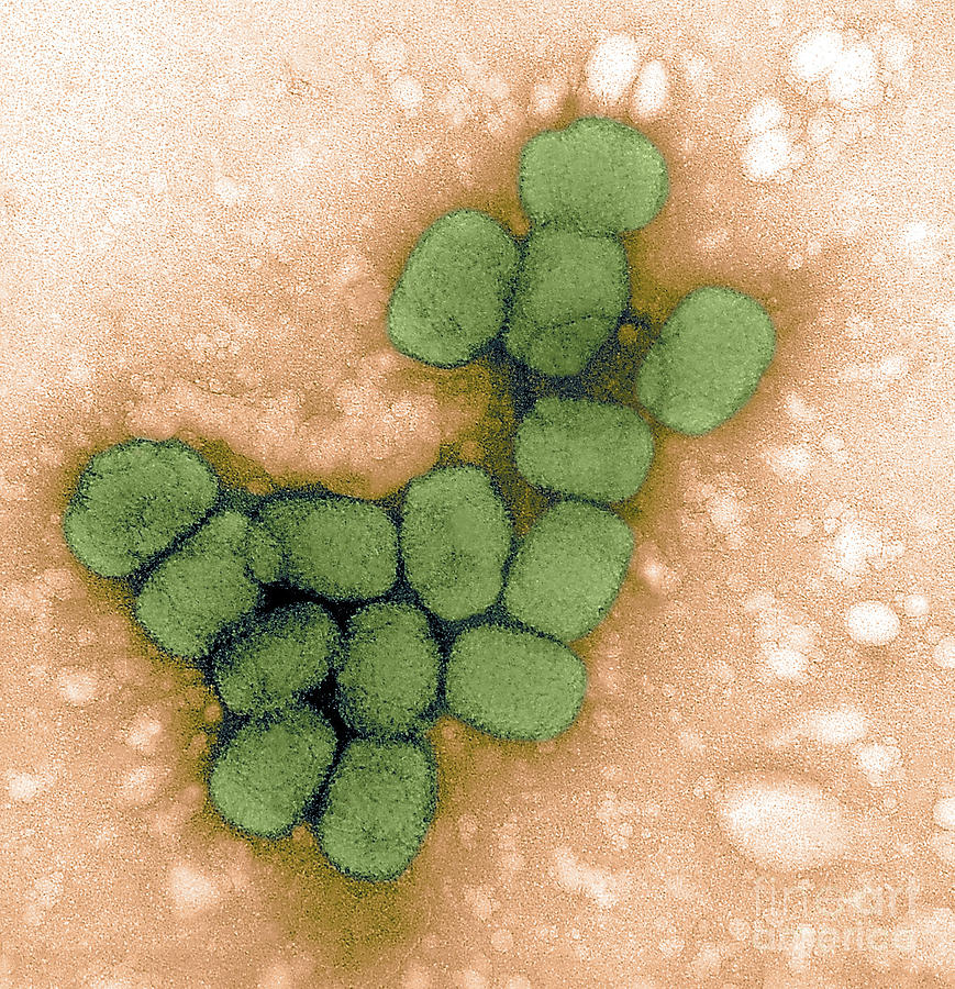Smallpox Viruses, Tem Photograph by Science Source