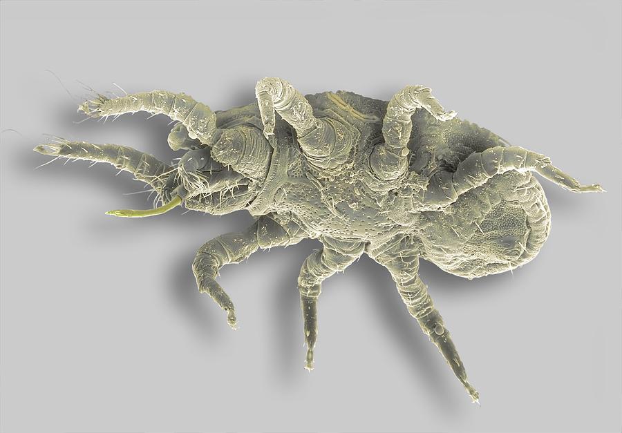 Soil Mite, Sem Photograph by Steve Gschmeissner - Fine Art America