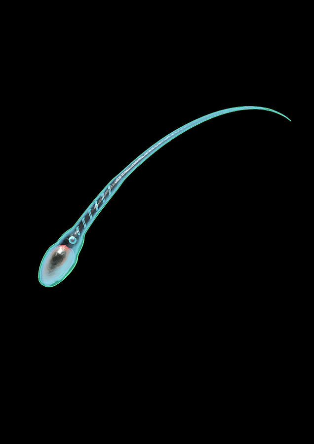 Sperm Cell, Computer Artwork Photograph by Robert Brocksmith - Fine Art ...