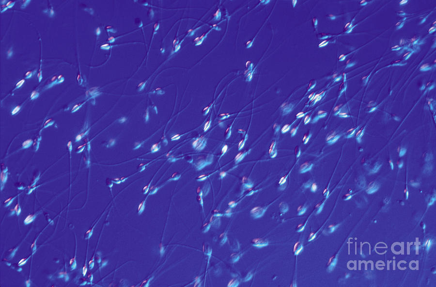 Spermatozoa Photograph by M. I. Walker