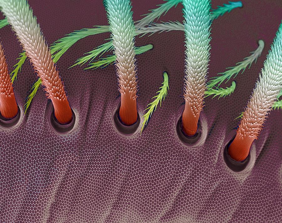 Springtail Body Hairs, Sem Photograph by Steve Gschmeissner