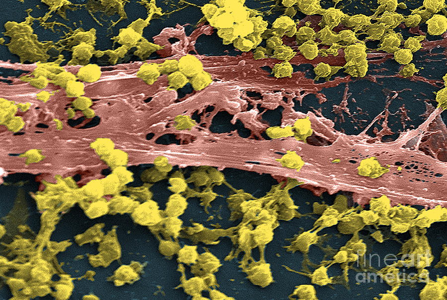 Staphylococcus Aureus Bacteria, Sem Photograph by Science Source