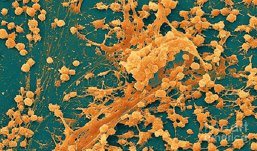 Staphylococcus Biofilm Photograph by Science Source