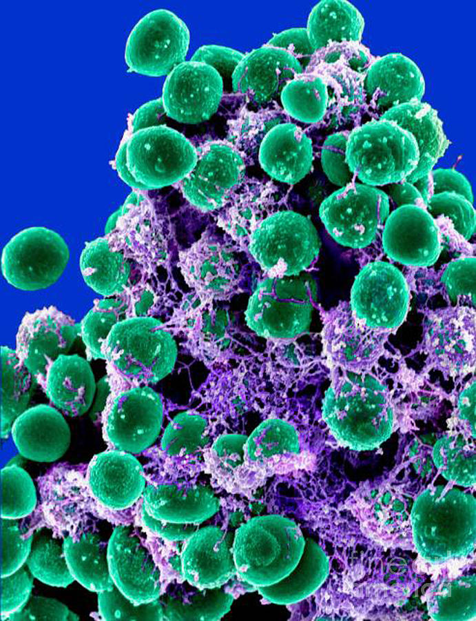 Staphylococcus Epidermidis Bacteria, Sem Photograph by Science Source