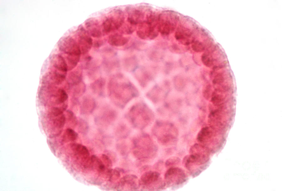 Starfish Embryo Photograph by Science Source - Fine Art America