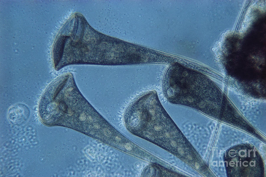Stentor Protist Photograph by Eric Grave