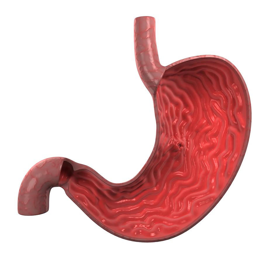 Illustration Photograph - Stomach Ulcer, Artwork by Sciepro