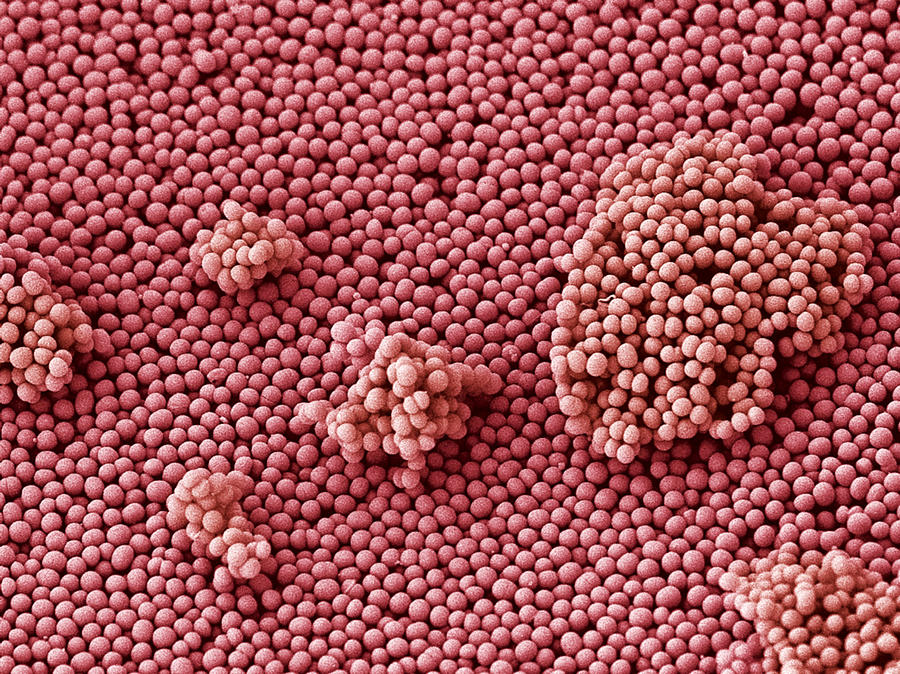 Pathogen Photograph - Streptococcus Bacteria, Sem by Steve Gschmeissner