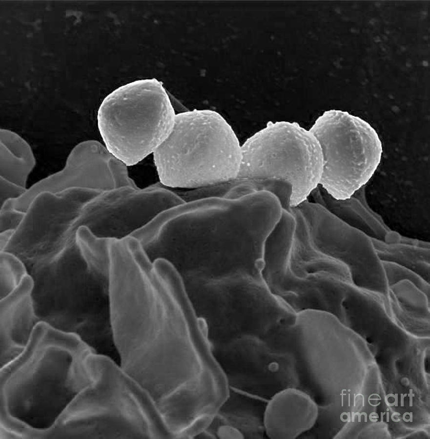 Streptococcus Pyogenes Bacteria, Sem Photograph by Science Source