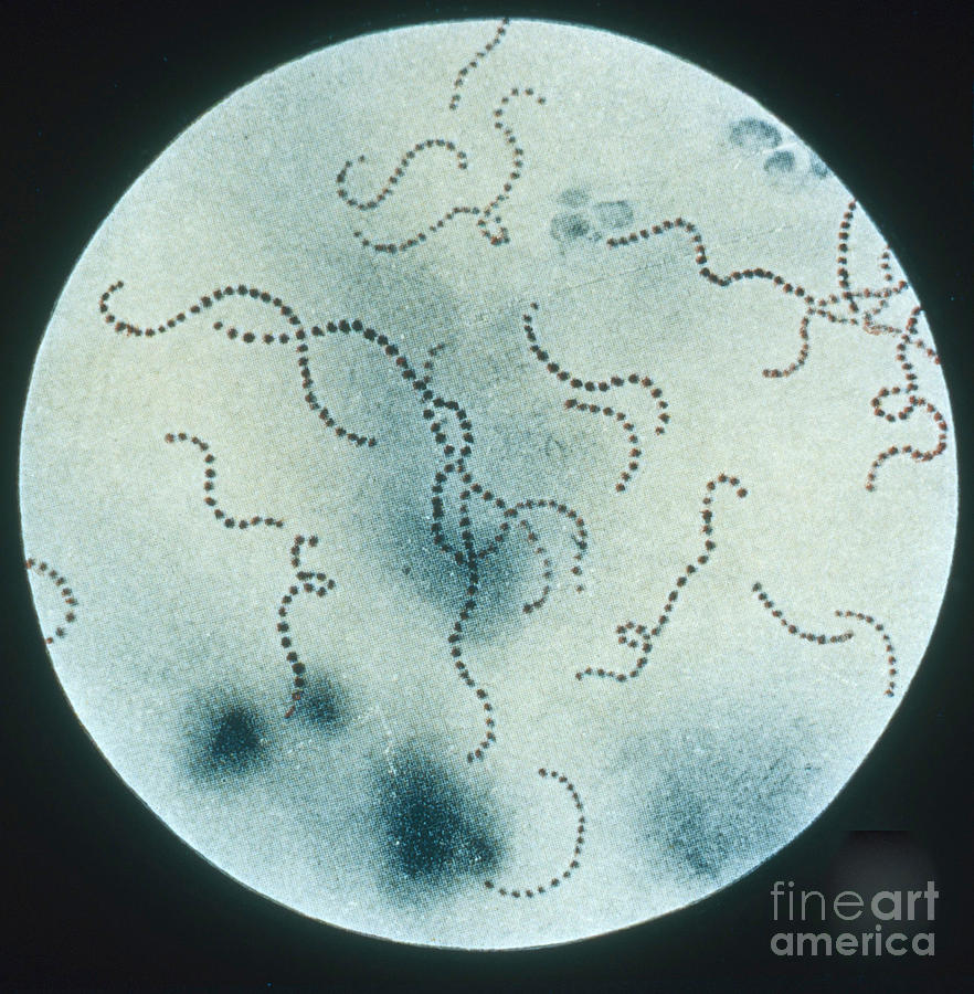 Streptococcus Pyogenes Photograph by Science Source
