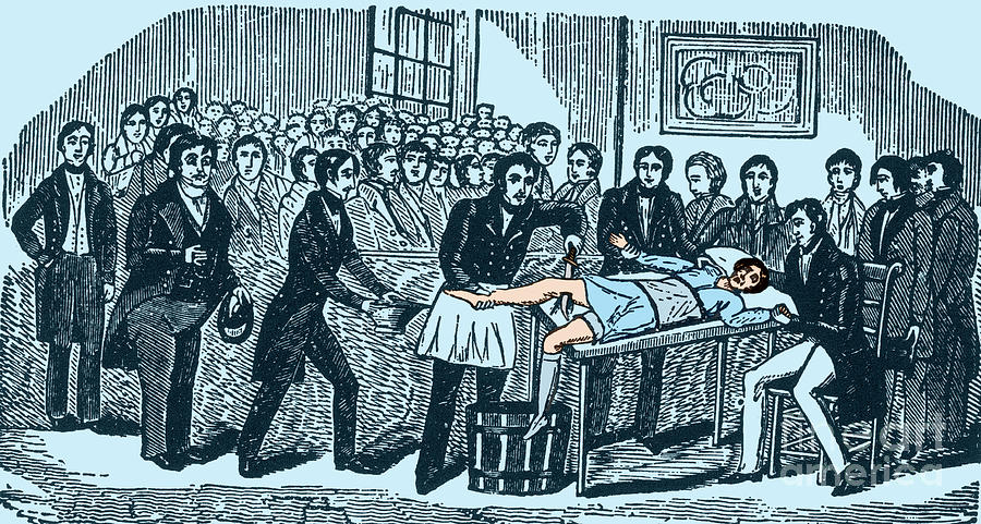 Surgery Without Anesthesia, Pre-1840s Photograph by Science Source