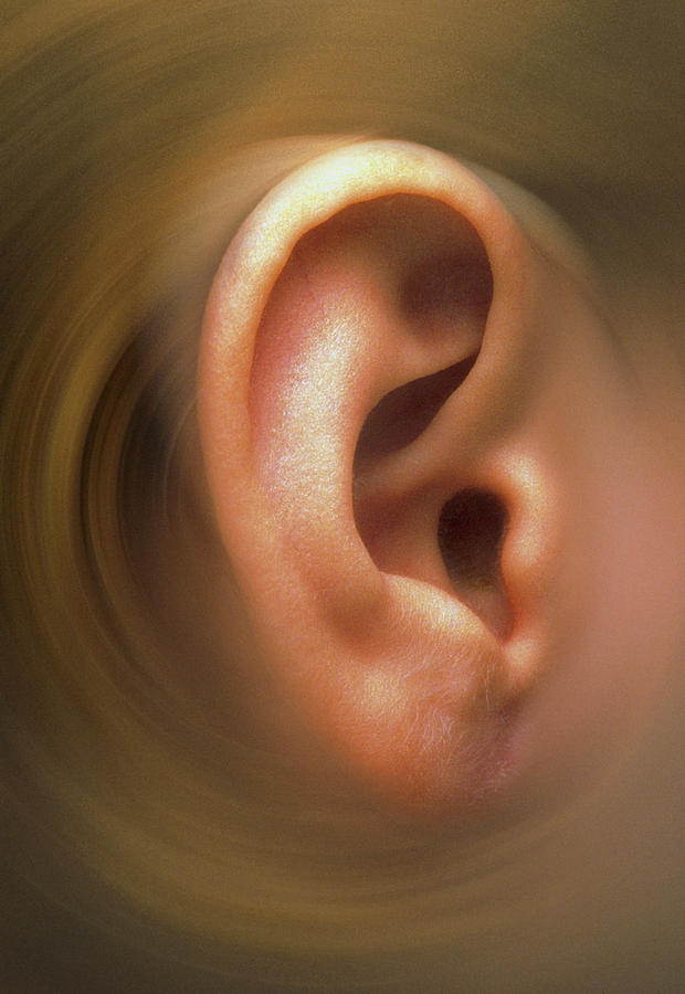 Swirling Effect Around Ear Pinna Of A Child Photograph by Victor De