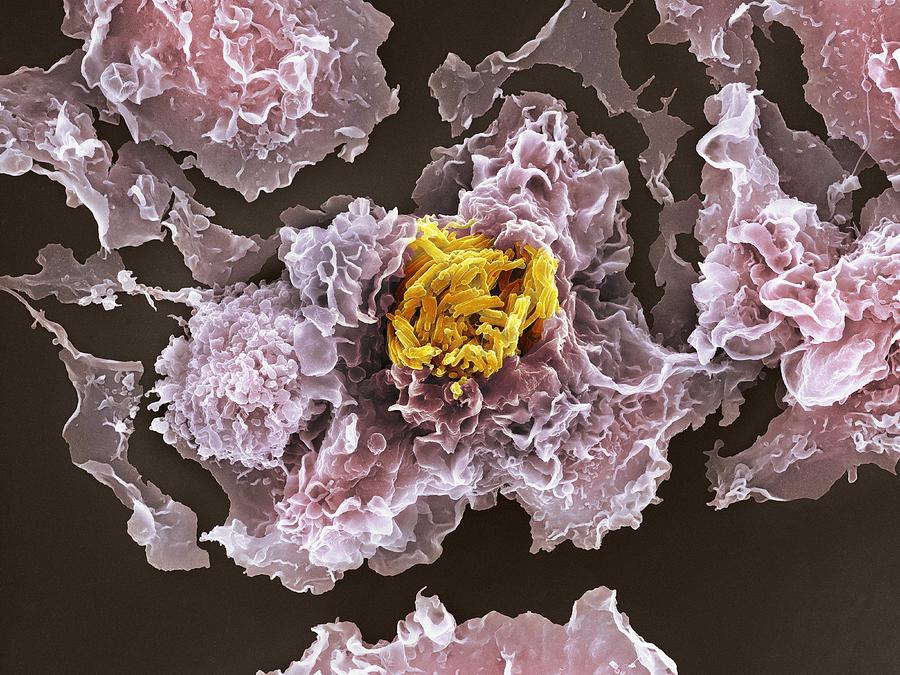 Tb Bacteria Infecting Macrophages, Sem Photograph by 