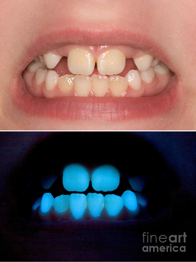 Teeth Photograph by Ted Kinsman