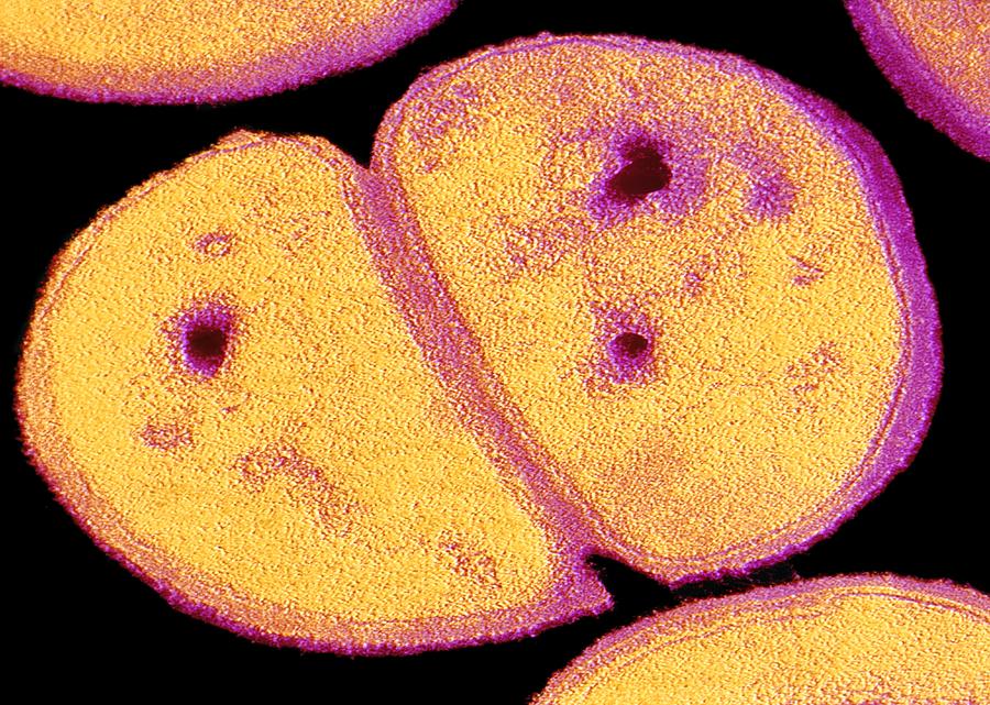 Tem Of Dividing Staphylococcus Aureus Photograph By Cnri Pixels