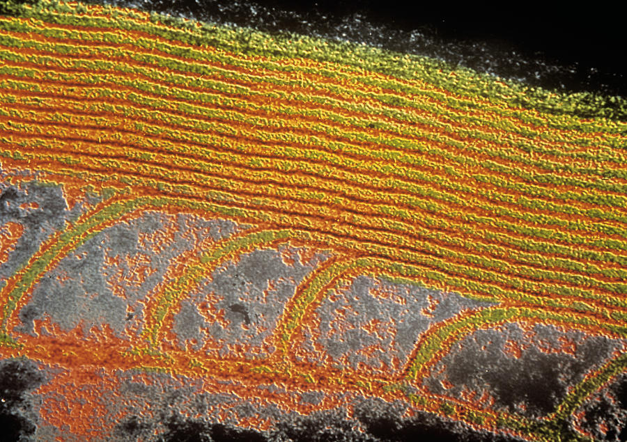 Images Photograph - Tem Of The Myelin Sheath Around The Auditory Nerve by Cnri