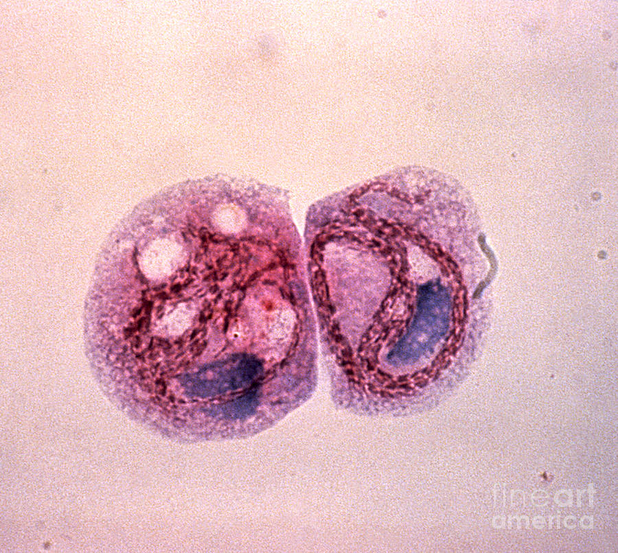 Tetrahymena Pyriformis Photograph by Science Source
