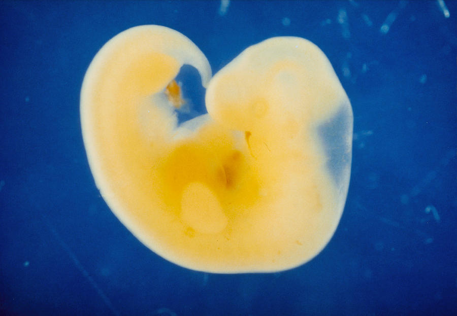 На 3 неделе тянет. Эмбрион на 3 неделе беременности. Эмбрион на 3 неделе беременности фото. Зародыш 2-3 недели беременности от зачатия. 2-3 Недели беременности эмбриональные.