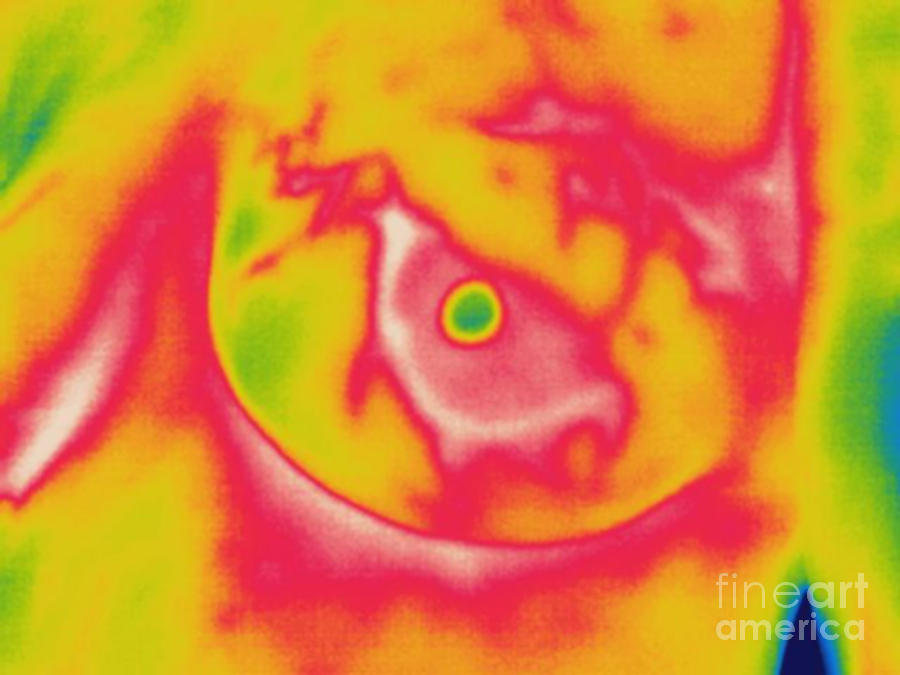 Thermogram Of A Lactating Womans Breast Photograph by Ted Kinsman