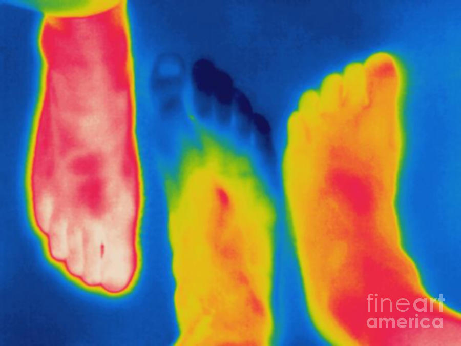 Thermogram Photograph - Thermogram Of Circulation In Feet by Ted Kinsman