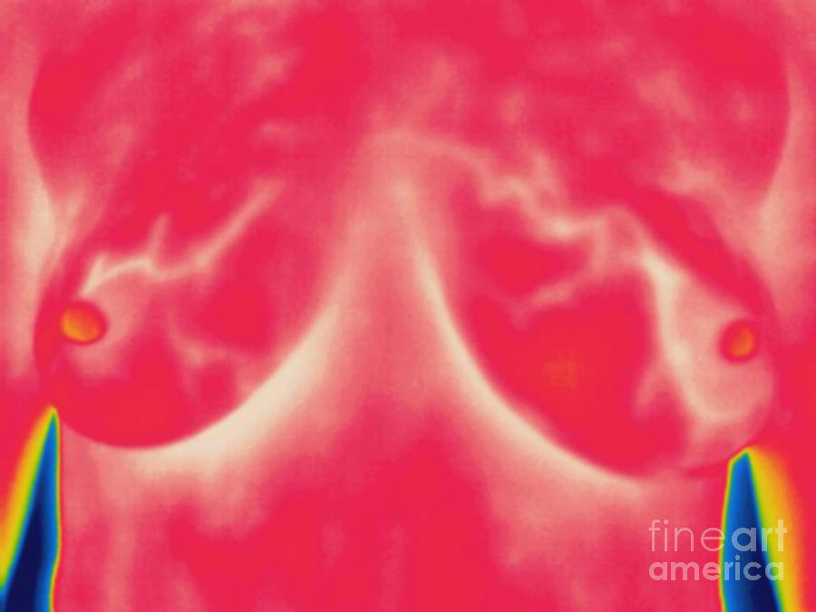 Thermogram Of Lactating Womans Breasts Photograph by Ted Kinsman