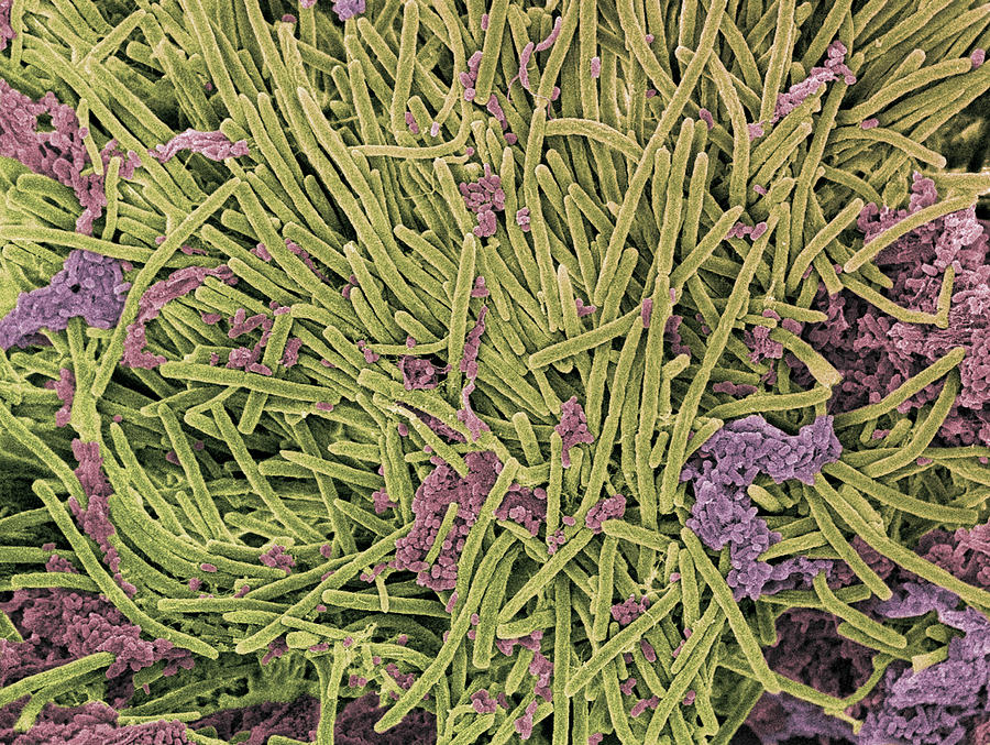 Micro-organisms Photograph - Tongue Bacteria, Sem by Steve Gschmeissner