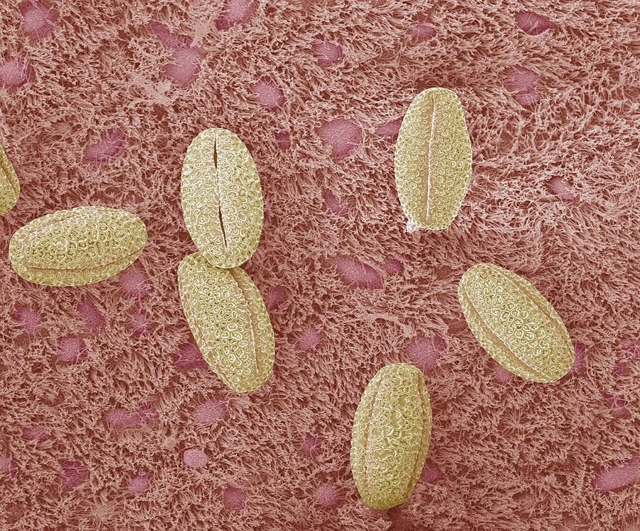 Pollen Photograph - Trachea With Pollen Grains, Sem by Steve Gschmeissner