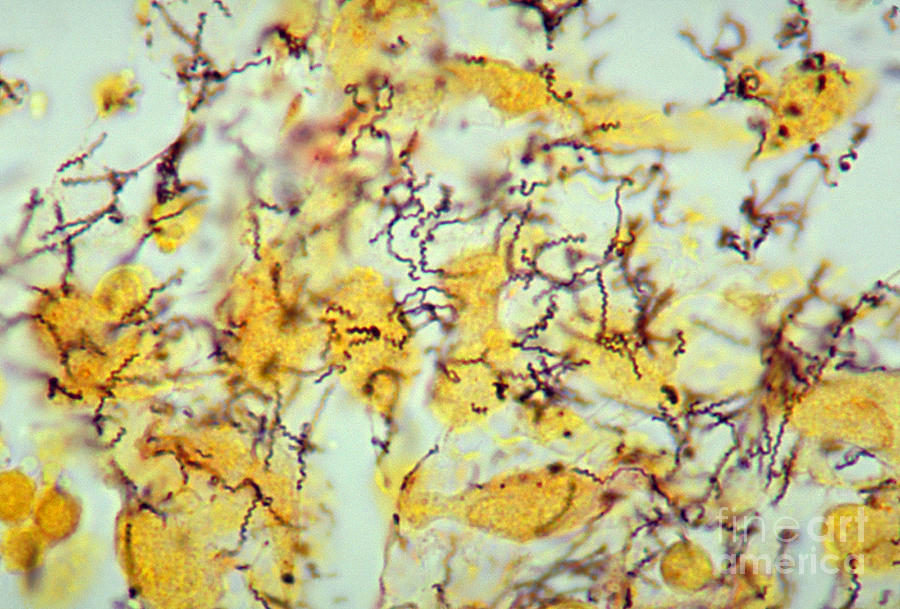 Treponema Pallidum Spirochetes Photograph by Science Source