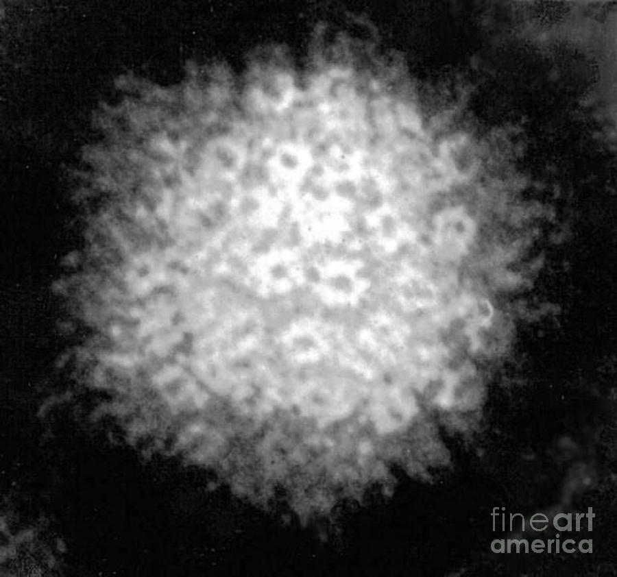Varicella-zoster Virus Photograph by Science Source