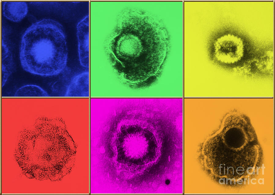 Various Forms Of Herpes Simplex Virus Photograph by Science Source