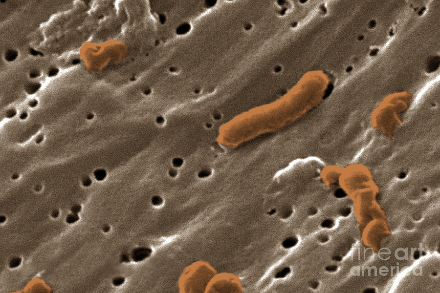 Vibrio Cholerae Bacteria, Sem Photograph by Science Source
