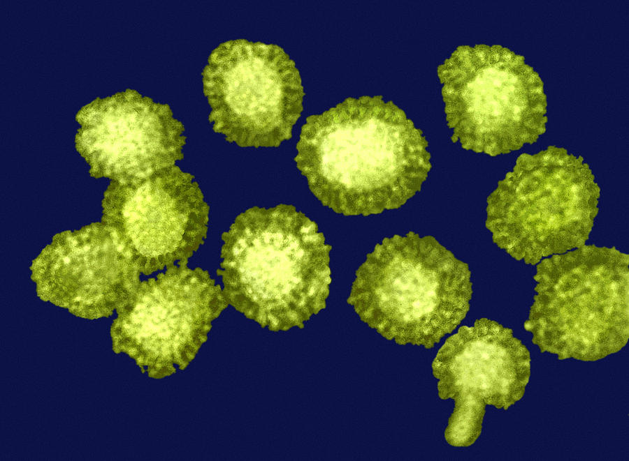 West Nile Virus Photograph - West Nile Viruses, Tem by Dr Linda Stannard, Uct