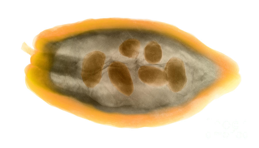 X-ray Of A Cocoa Pod Photograph by Ted Kinsman