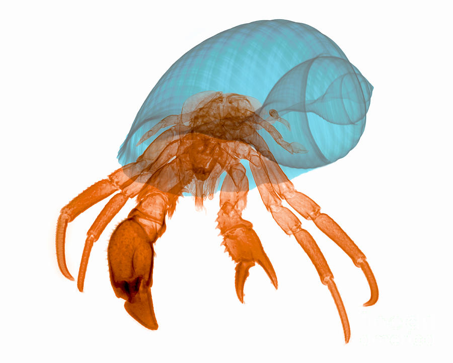 X-ray Of Hermit Crab Photograph by Ted Kinsman