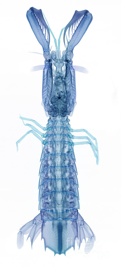 X-ray Of Mantis Shrimp Photograph by Ted Kinsman
