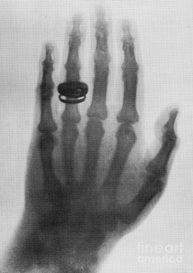 X-ray Photograph by Science Source