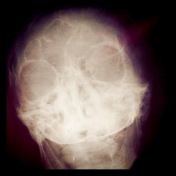 Human Photograph - X-rays by Alexandr Abramov