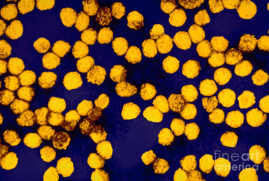 Yellow Fever Virus, Tem Photograph by Science Source