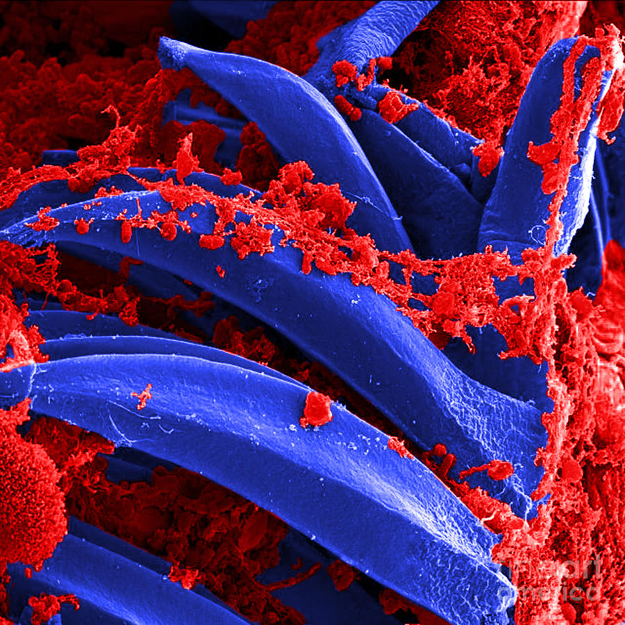 Yersinia Pestis Bacteria Sem Photograph by Science Source