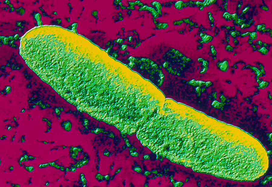 Yersinia Pestis Photograph - Yersinia Pestis (plague) Bacteria by Pasieka