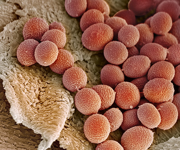 Fungal Spores, Sem by Steve Gschmeissner