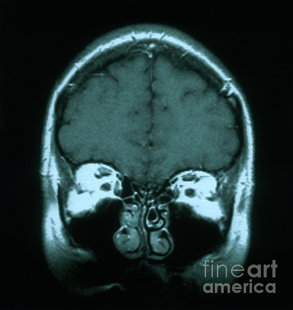 Mri Of Normal Brain #7 Tapestry by Science Source - Science Source Prints