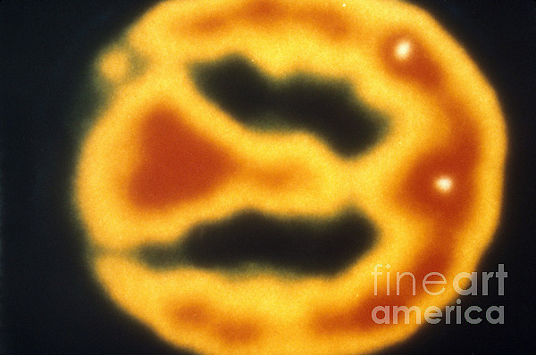 Pet Scan Of Normal Brain Tapestry by Science Source - Science Source Prints