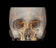 Brain Arteries And Circle Of Willis #1 Photograph by Science Photo Library