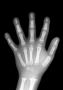 Child's Hand #1 Photograph by Science Photo Library